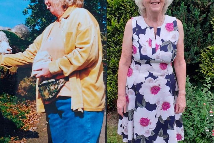 Marion Rainthorpe before and after