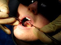Dozens of hospital admissions in the Forest of Dean to remove children's rotten teeth