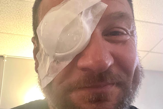 Golfer blinded in one eye by wayward shot