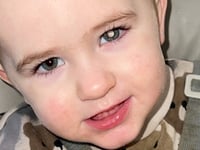 Dad goes extra mile after tot's white glow eye cancer shock