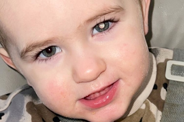 Koopers left eye with the glow.  A toddler was diagnosed with eye cancer after his parents noticed a white glow in his left eye.  Shane Stevenson, 35, and his partner, Lowri Gallagher, 30, were at home when they noticed a white glow in their then one-year-old son, Kooper's eye.  It was only noticeable in low-light conditions or when they took a photo of Kooper with the flash on.  An ultrasound revealed a lump in Kooper's eye, and he was referred to Birmingham Women and Childrens Hospital in December 2024.  He underwent an optical coherence tomography scan -  an advanced scan that allows opticians to assess your eye health -  before he was diagnosed with retinoblastoma - a rare eye cancer that typically affects children under the age of six.  In December 2024, Kooper started intra-arterial chemotherapy -  a targeted cancer treatment where chemotherapy drugs are delivered directly to the area - before having laser therapy and one round of chemotherapy injections.  The tot is still undergoing treatment, and Shane said the results have been "mixed". 